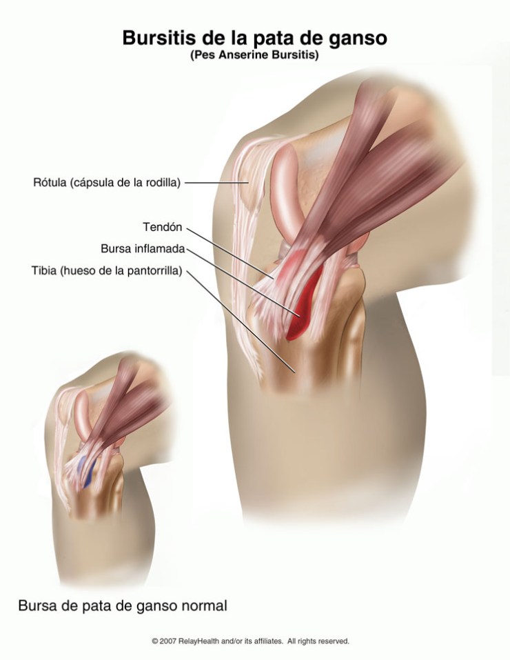 pata-de-ganso.jpg