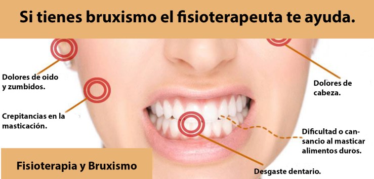 141-bruxismo-si_tienes_bruxismo_el_fisioterapeuta_te_ayuda