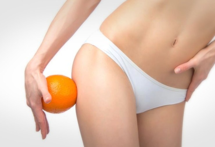 Tratamiento-celulitis-como-eliminarla.